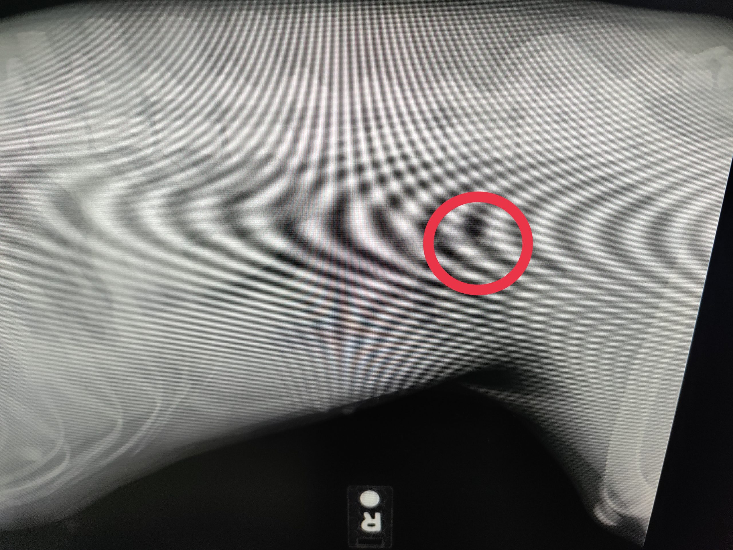 Cassie Obstruction Episode